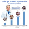 Infographic showing four stages to remove onychomycosis, demonstrating the visible treatment effect over 7-8 weeks.