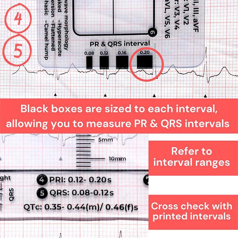 ECG 7-Step Interpretation Ruler Card