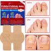 Box and application of Funga Fungal Nail Patche patches for overnight nail repair
