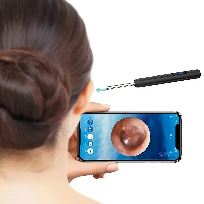 A person is using an HD Visual Ear Cleaner with a camera and LED light to examine an ear.