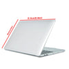 Clear Hard Shell Case for MacBook Pro 13 Inch (2016–2022, M1 & Intel)