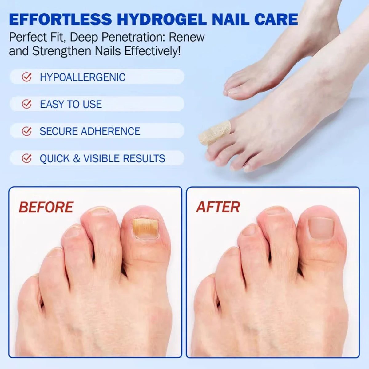 Before and after images showing the application of an effortless hydrogel nail care product on toenails.