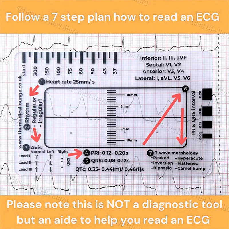 ECG 7-Step Interpretation Ruler Card