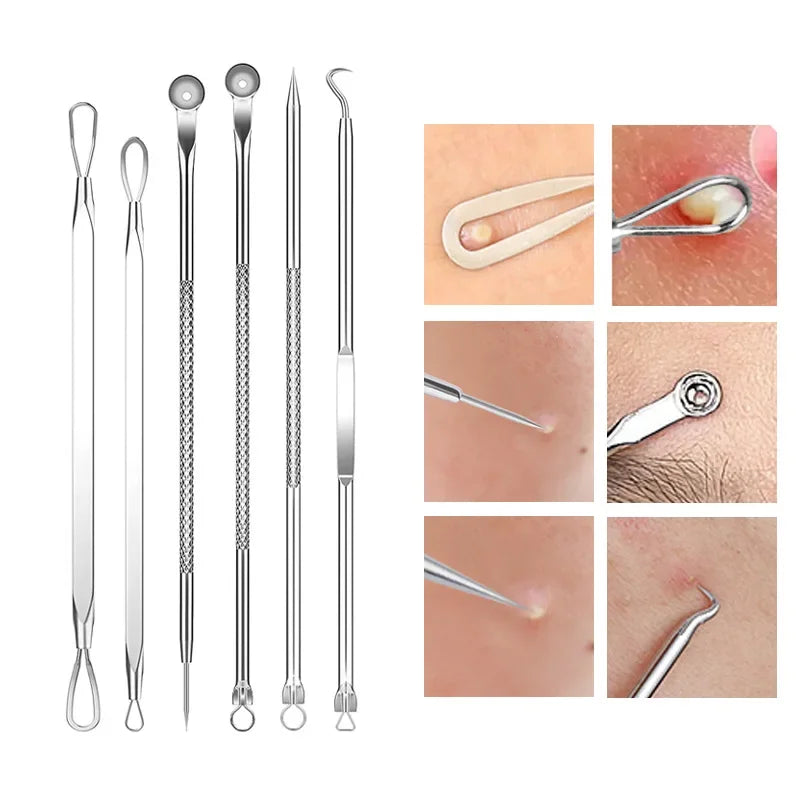 A set of stainless steel tools for acne and blackhead removal, including various types of extractors and scrapers.