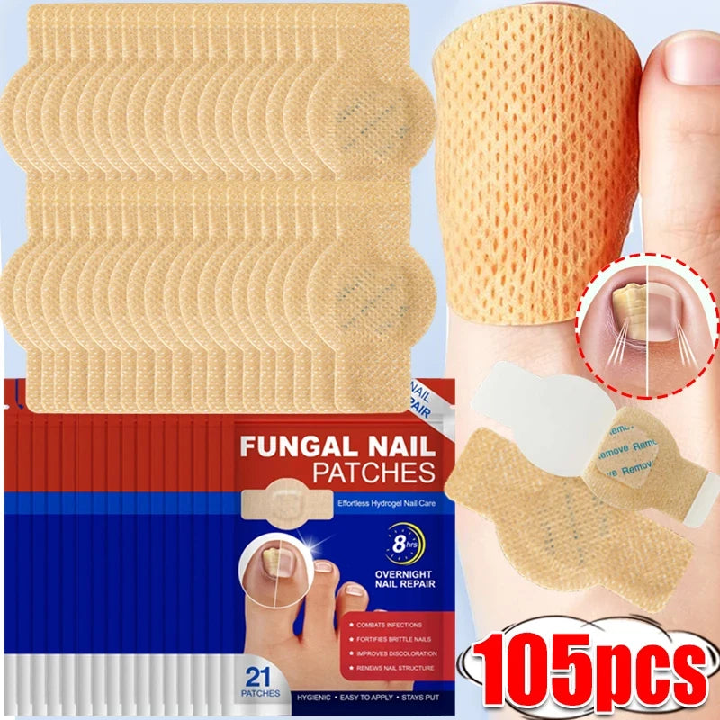 Pack of 105 fungal nail patches for overnight repair of nails