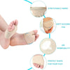 A beige stretchable fabric forefoot cushion pad with a soft silicone pad for foot pain relief.