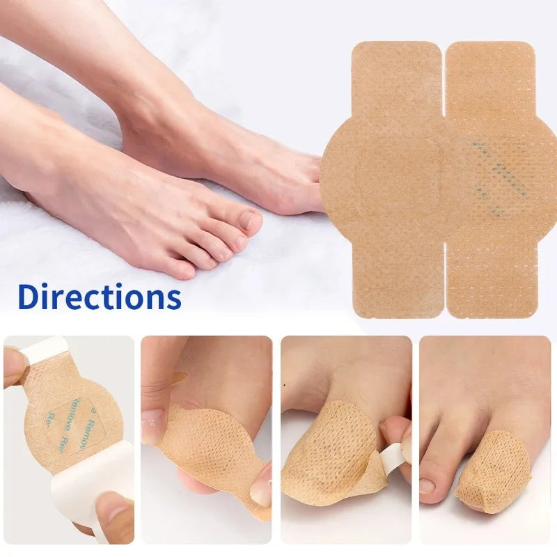 Instructions showing how to apply nail repair patches for fungus and ingrown toenails on the foot.