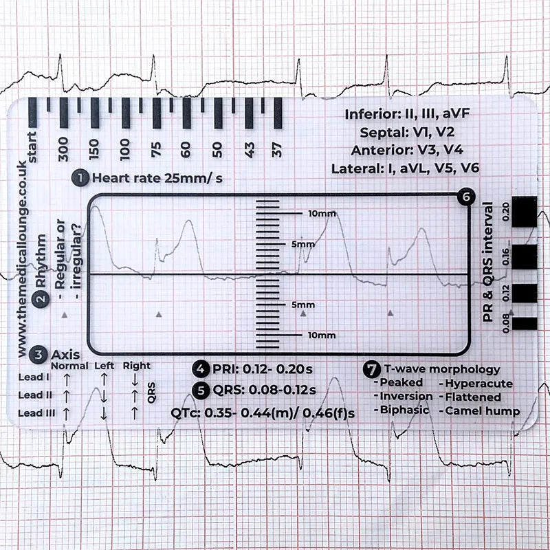 ECG 7-Step Interpretation Ruler Card