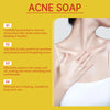 A close-up of a hand applying acne soap to the neck and shoulder area of a woman's skin.