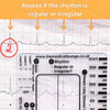 ECG 7-Step Interpretation Ruler Card