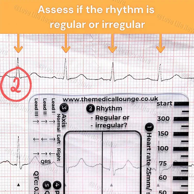 ECG 7-Step Interpretation Ruler Card