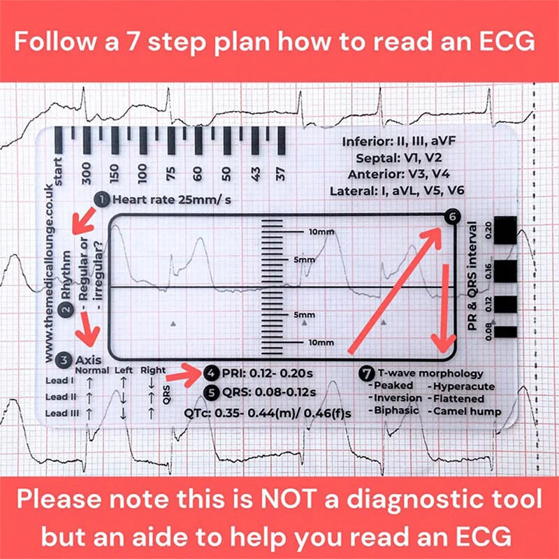ECG 7-Step Interpretation Ruler Card