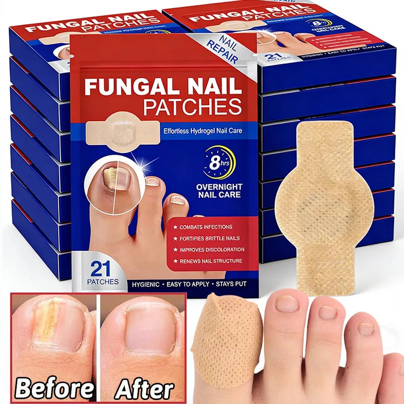Box of fungal nail patches and a beige patch on a finger showing before and after results.