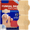 Box of 21 fungal nail patches for overnight nail repair on toenails