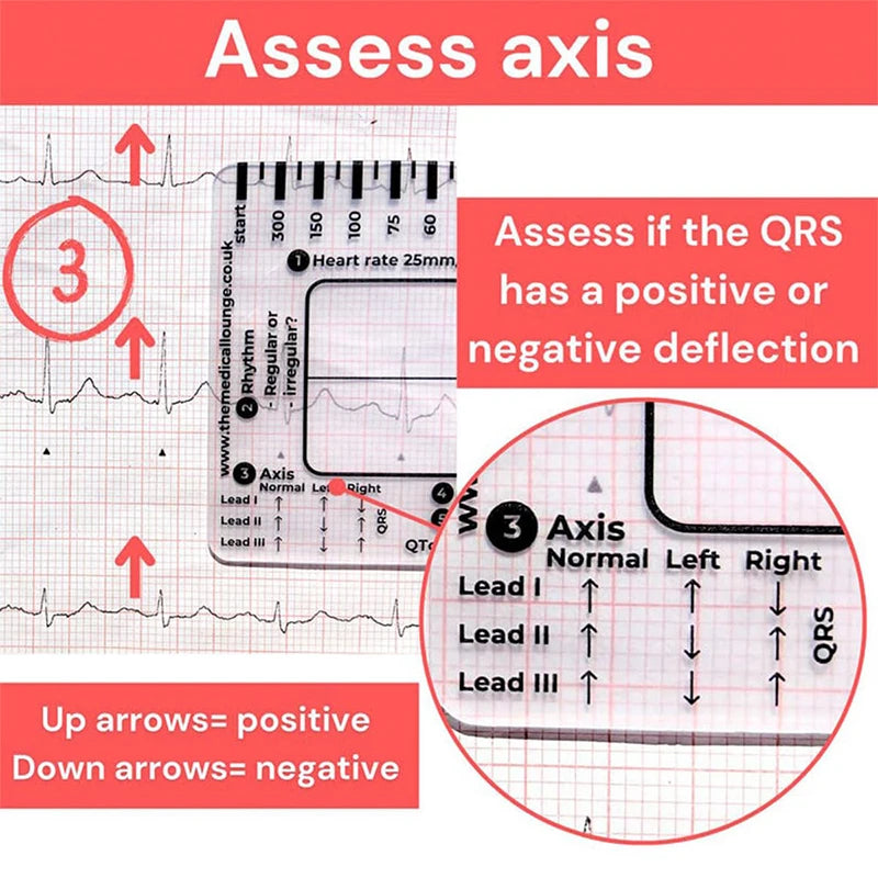 ECG 7-Step Interpretation Ruler Card