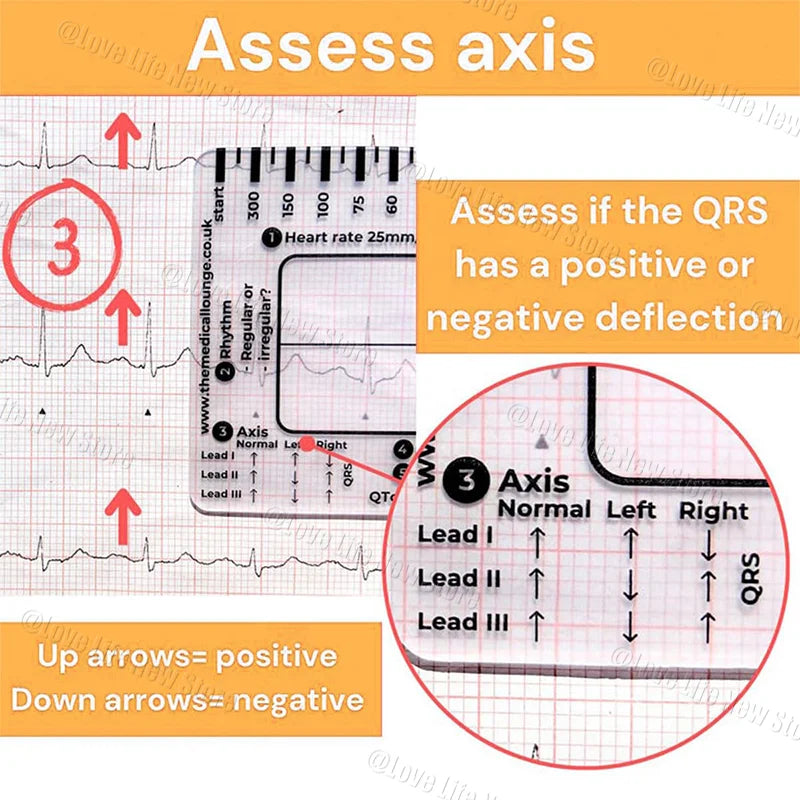 ECG 7-Step Interpretation Ruler Card