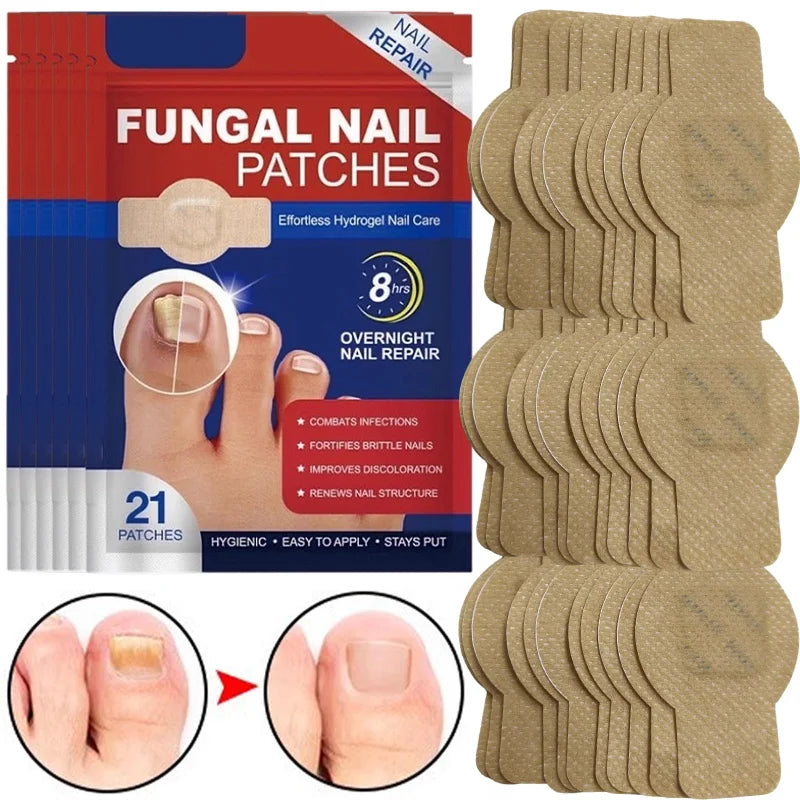 Pack of 21 fungal nail patches for overnight nail repair and infection combat.