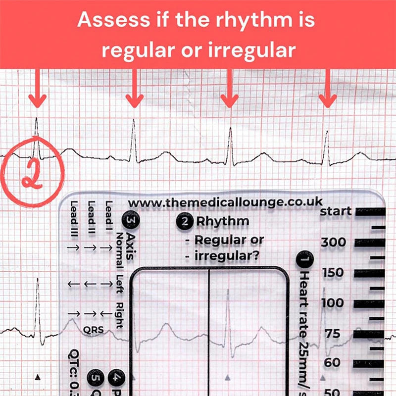 ECG 7-Step Interpretation Ruler Card